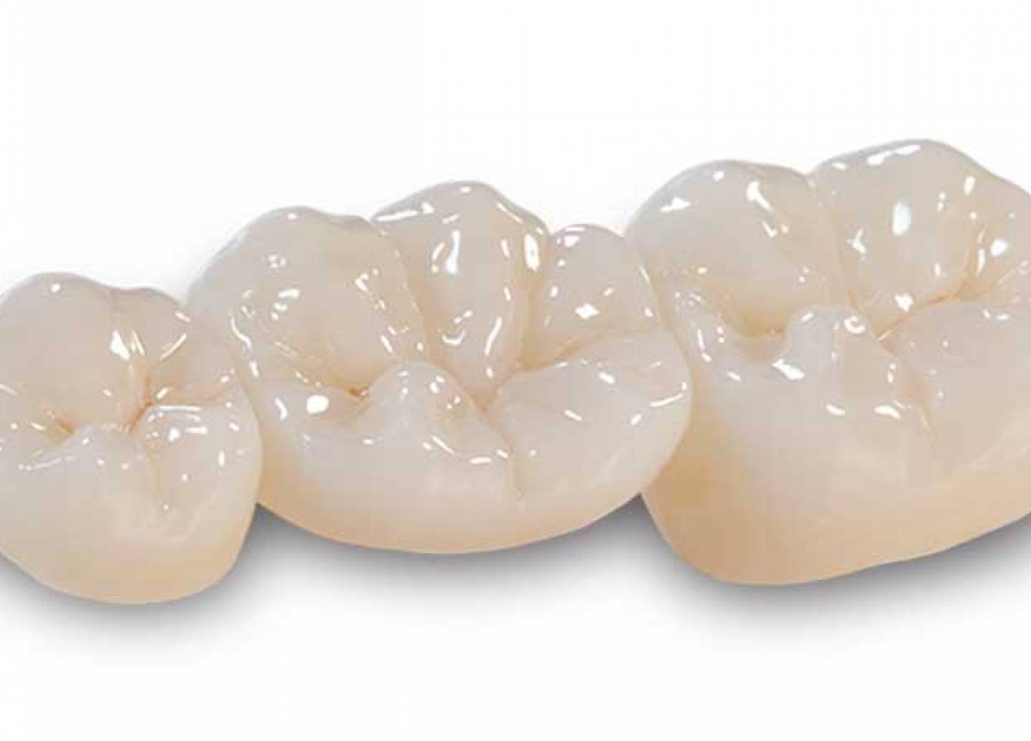 Zirconium Oxide in Dental Field