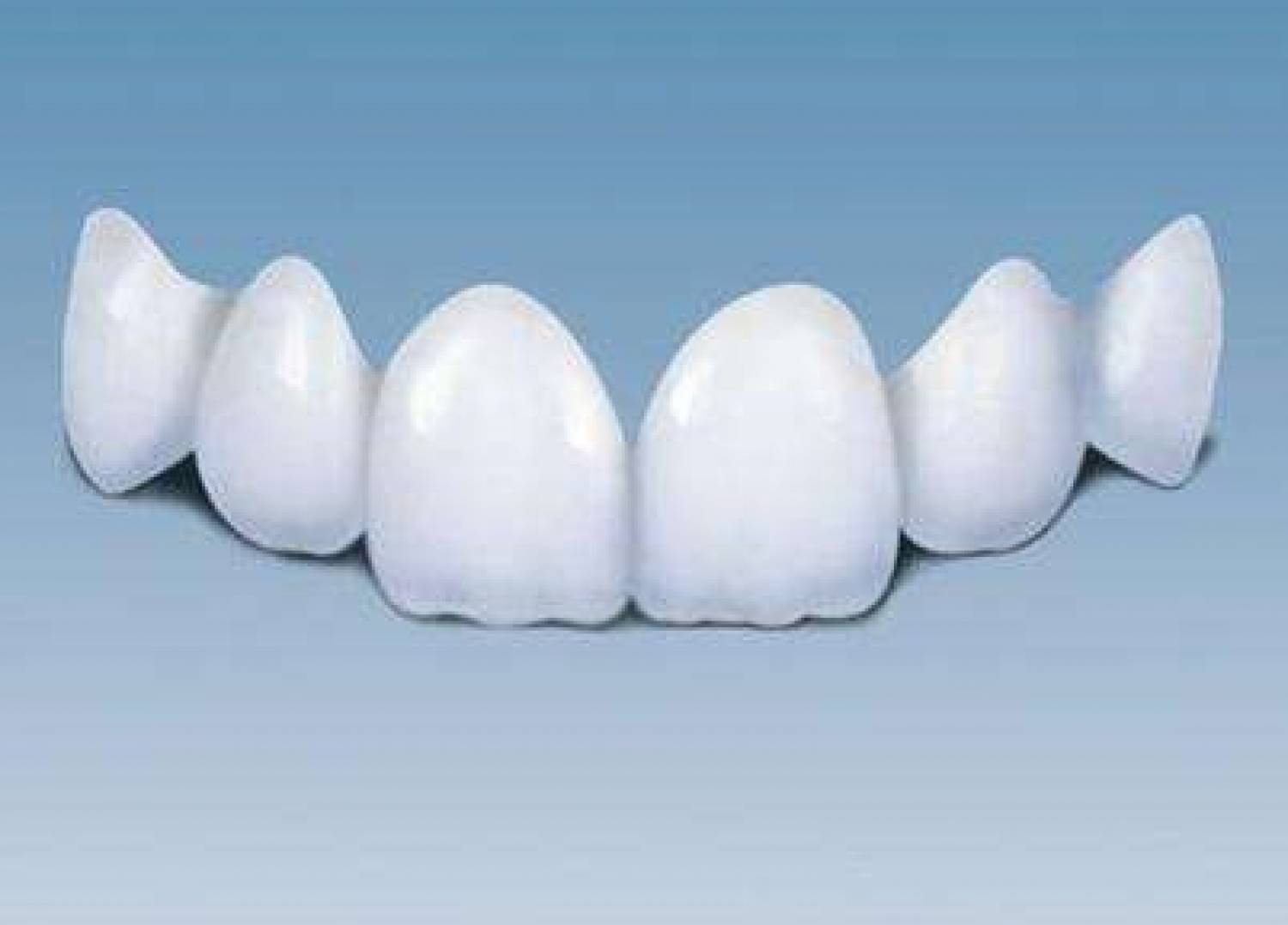 Acid-resistant Ceramic-Zirconia