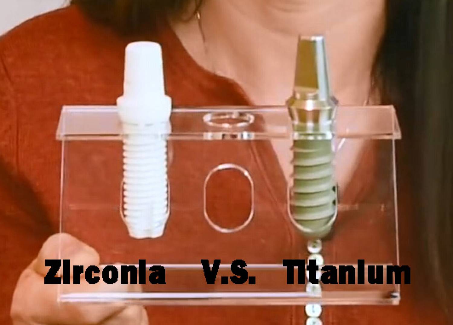 Titanium Vs. Zirconia: Which Material of Dental Implant is Good for You?