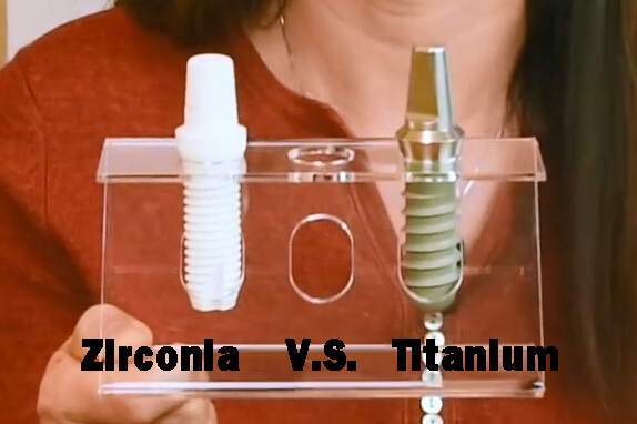 zirconia and titanium dental implants