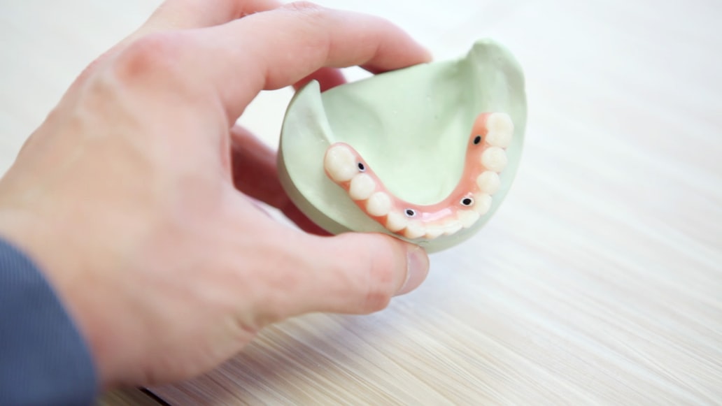 What You Need to Know About Zirconia Implants