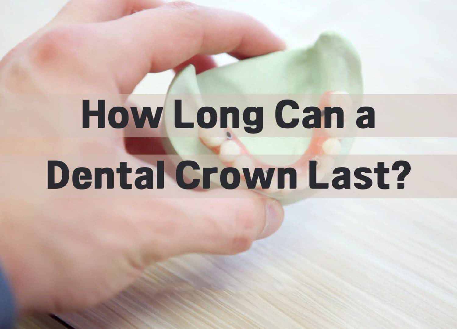 How Long Can a Dental Crown Last?